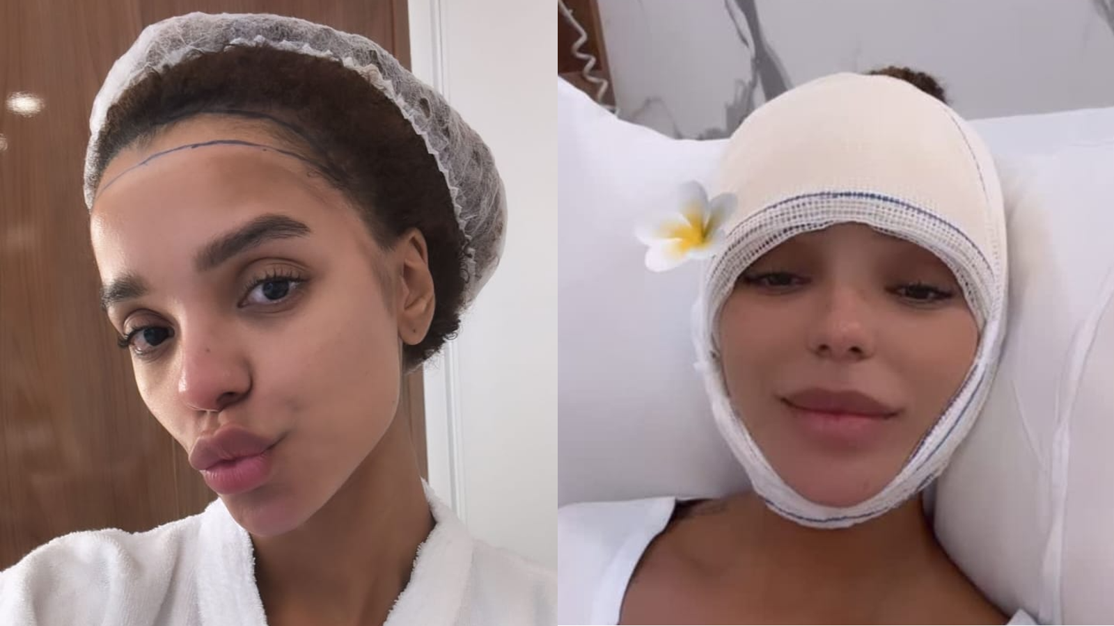 Brunna comentou também que teve dificuldade em achar conteúdo de pessoas que já tinham feito a cirurgia