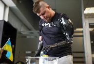 Com inteligência artificial e mãos biônicas, soldados ucranianos voltam à ação