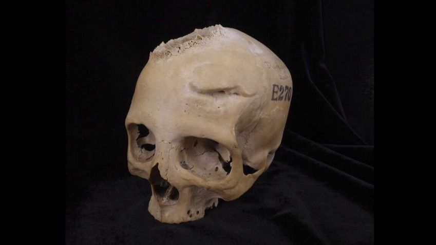 O crânio E270, datado de entre 664 a.C. e 343 a.C., pertencia a uma mulher com pelo menos 50 anos, segundo o estudo (Divulgação Tondini, Isidro, Camarós via CNN Newsource)