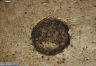 Remoção de tumor em crânio de 4 mil anos revela marco no tratamento de câncer