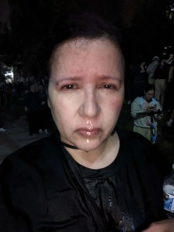 Dolores Quintana fotografada logo após receber spray de pimenta enquanto cobria os protestos na UCLA no início de maio de 2024 / Dolores Quintana