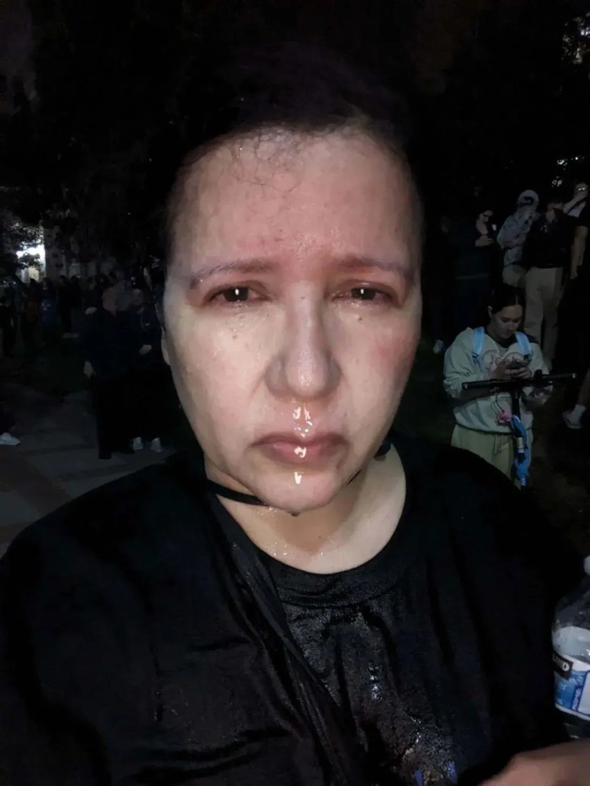 Dolores Quintana fotografada logo após receber spray de pimenta enquanto cobria os protestos na UCLA no início de maio de 2024 / Dolores Quintana