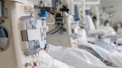 Aparelho de hemodiálise em hospital