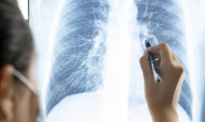Doctor checking coronavirus patient chest x-ray film at ward hospital.
