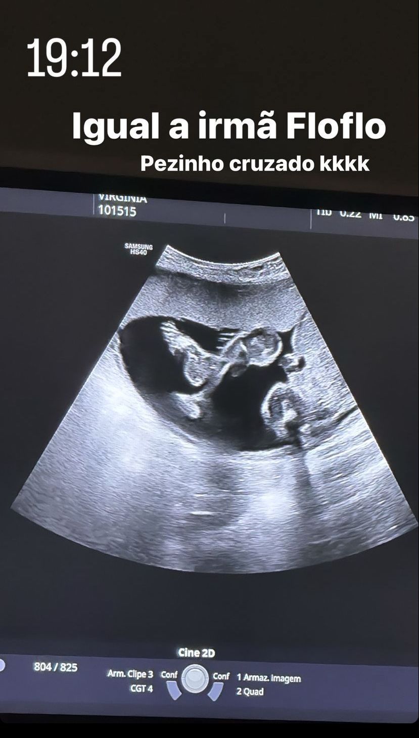 Virginia mostra imagens de bebê em novo ultrassom / Reprodução/Virginia/Instagram