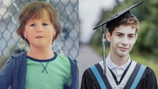 Protagonista do filme “Extraordinário” chocou a internet pela “rapidez” em que cresceu