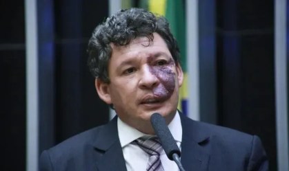 Imagem de destaque do post: Vice-líder do governo defende limitar a dez anos mandato de ministro do STF
