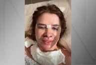 Mãe de Viih Tube passa por 6 horas de cirurgia e celebra: "Olha o contorno"