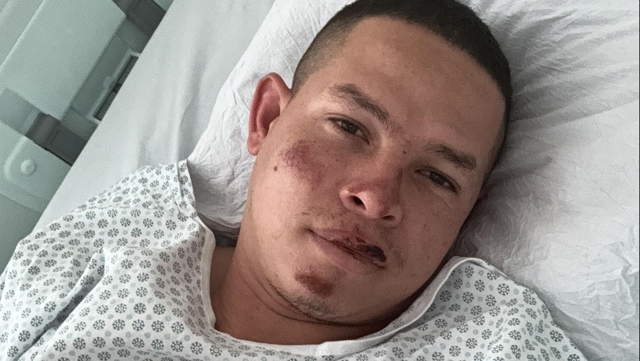 Paraquedista colombiano Jhovanny Durán no hospital