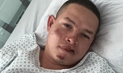 À CNN, paraquedista que caiu em balão relata “quase morte”: “Pensei na minha filha”