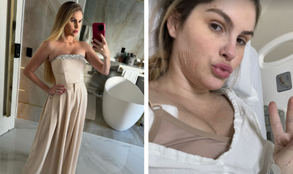 Bárbara Evans detalha novas cirurgias plásticas que realizou; saiba quais