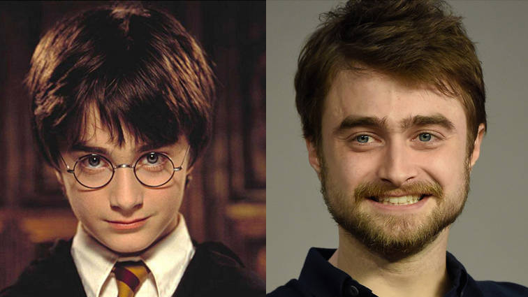 Antes e depois do ator Daniel Radcliffe / Reprodução