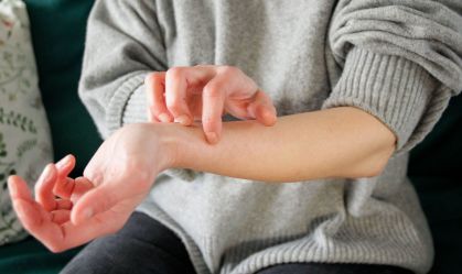 Dermatite atópica: novo medicamento é opção para casos moderados e graves