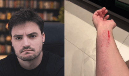 Felipe Neto sofre acidente doméstico: "Pior tombo da vida"