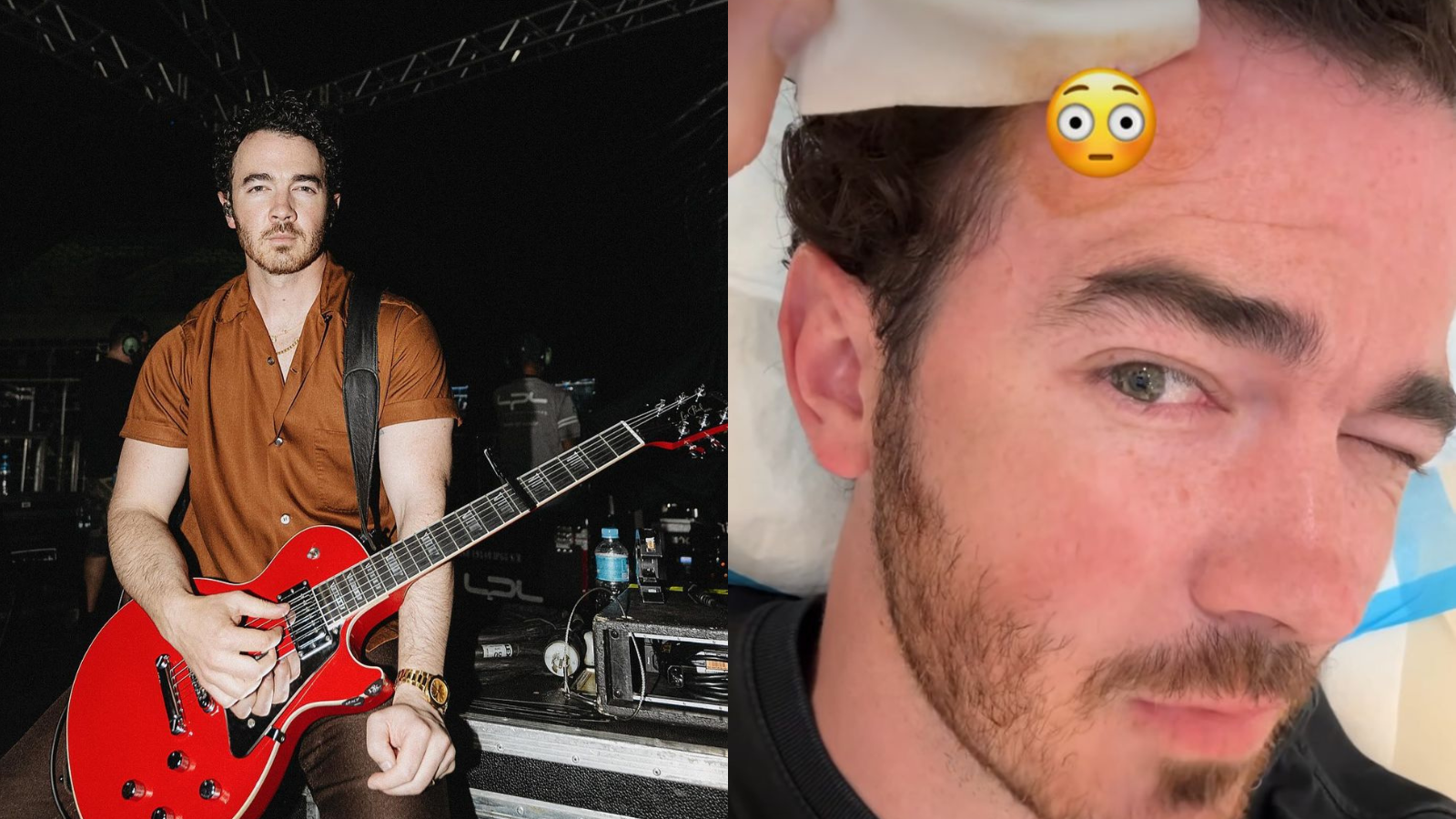 Kevin Jonas revelou que fez uma cirurgia para remover um câncer de pele
