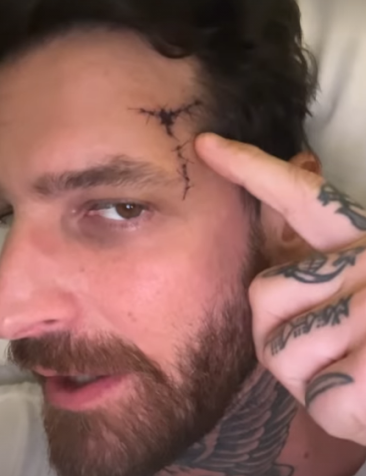 Marido de Cleo, Leandro D'Lucca, sofre traumatismo craniano / Instagram/ Leandro D'Lucca