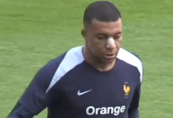 Mbappé usa proteção no nariz em treino da França; veja imagens