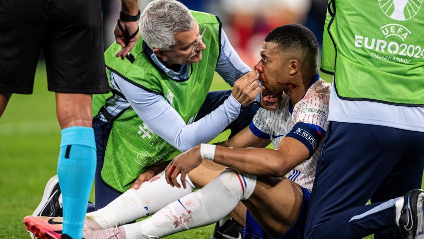 Mbappé tem forte sangramento no nariz após choque com zagueiro austríaco / Marvin Ibo Guengoer - GES Sportfoto/Getty Images