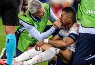 Imagem forte: nariz de Mbappé sai do lugar após trombada em jogo da França