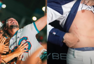 Nattan se machuca após se jogar na plateia durante show; veja vídeo