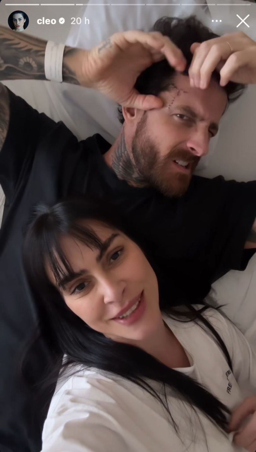 Cleo Pires mostrou como estão os pontos na testa do marido / Instagram/Cleo Pires