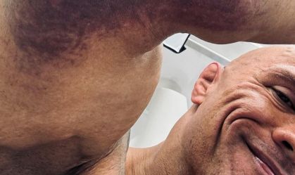 The Rock mostra hematomas após se machucar em set de "The Smashing Machine"