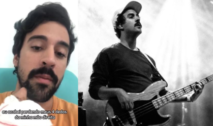 Baixista de banda de rock perde quatro dedos em acidente com buggy