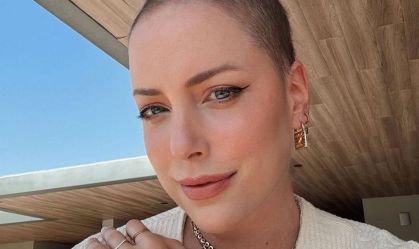 Fabiana Justus diz que fez transplante pelo SUS: "Dinheiro não comprou"