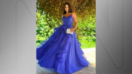A influenciadora Aline Ferreira, 33 anos, morreu após procedimento estético