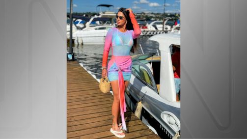 A influenciadora Aline Ferreira, 33 anos, morreu após procedimento estético