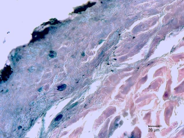 Imagem de microscópio da amostra, que exibe a epiderme, derme e tecido subcutâneo remanescentes, além do músculo estriado / Reprodução/Universidade de Estocolmo