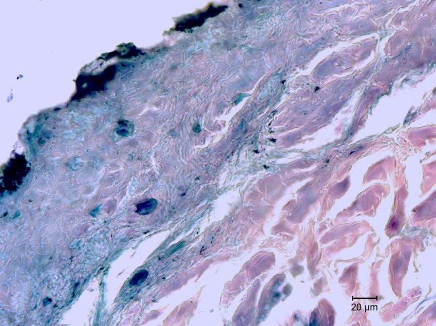 Imagem de microscópio da amostra, que exibe a epiderme, derme e tecido subcutâneo remanescentes, além do músculo estriado / Reprodução/Universidade de Estocolmo
