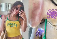 Anitta é queimada por água-viva em Ibiza: "Dor que nunca senti na vida"