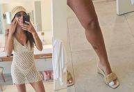 Após ser queimada por água-viva, Anitta perde unha do pé: "Sangue por todo lado"