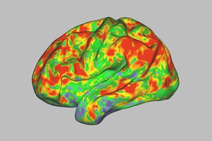 Imagem mostra a atividade cerebral de alguém que consumia cogumelos mágicos