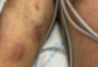 Homem torturado em clínica tinha lesões de diferentes datas, aponta laudo