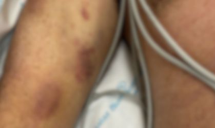 Homem torturado em clínica tinha lesões de diferentes datas, aponta laudo