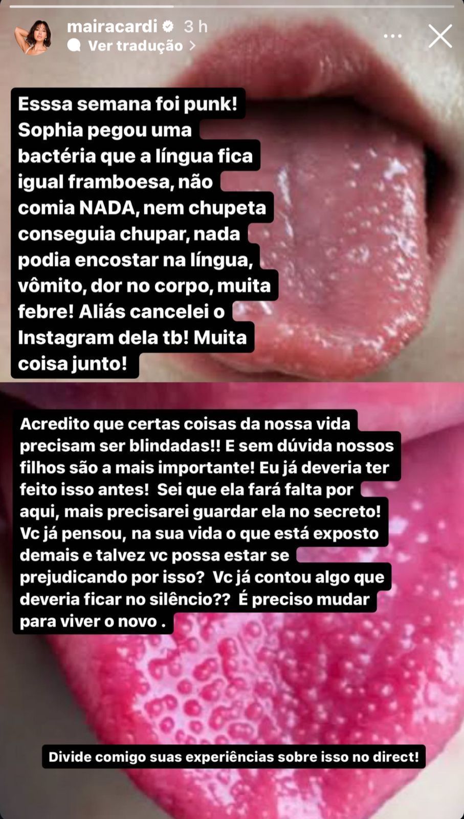 Maíra Cardi mostrou bactéria na língua da filha / Foto: Instagram/Maíra Cardi