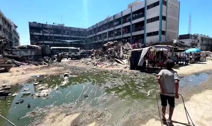 Superlotação e contaminação da água causam aumento de doenças de pele em Gaza