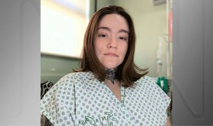 Neuralgia do trigêmeo: jovem relata melhora na "pior dor do mundo" após procedimento