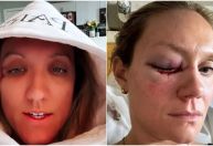 Atletas do vôlei feminino dos EUA sofrem acidente de carro após festa em Paris