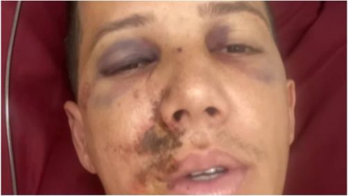 Árbitro Farllen Júlio foi agredido em torneio amador de futebol feminino em MG
