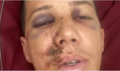 Árbitro desabafa após ser agredido em Minas: “Poderia estar em cadeira de rodas”