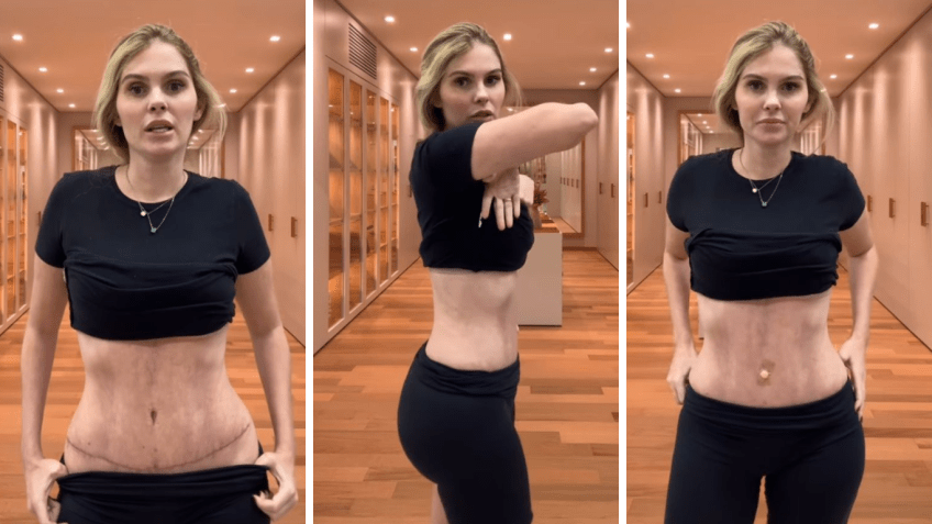 Bárbara Evans mostrou resultado de cirurgia plástica nas redes sociais / Instagram/Bárbara Evans