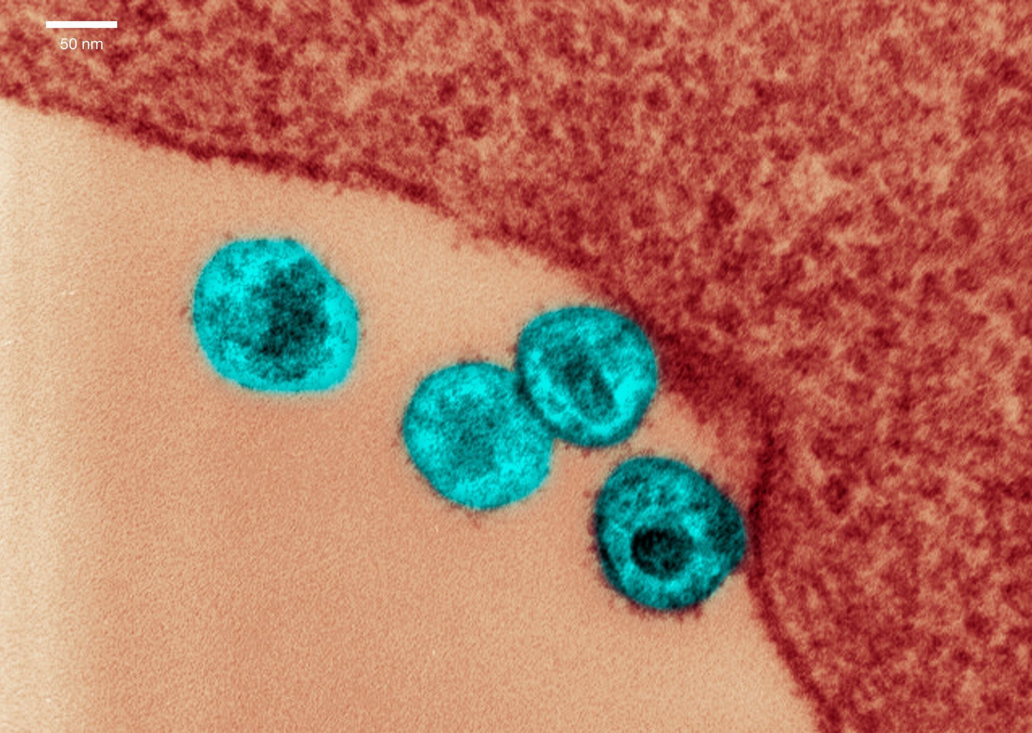 Micrografia eletrônica de transmissão do HIVelectron micrograph of HIV