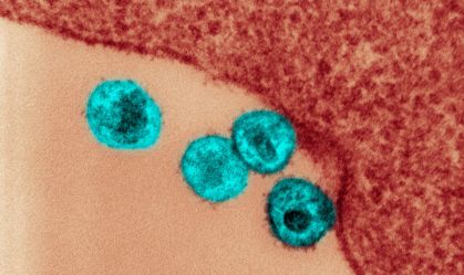 HIV: nova variante está circulando em três estados do Brasil, diz estudo