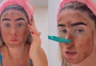 Influenciadora viraliza ao fazer skincare com fezes: "Deu certo pra mim"