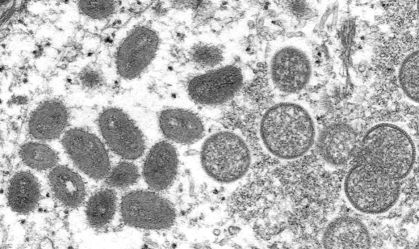 "No momento, não é razoável comparar mpox com Covid-19", diz presidente da Anvisa à CNN