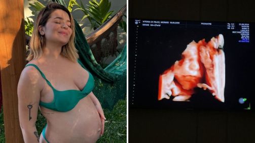 Viih Tube compartilha novas imagens do ultrassom do filho Ravi