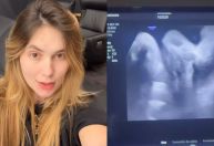 Grávida de 8 meses, Virginia mostra novo ultrassom do terceiro filho